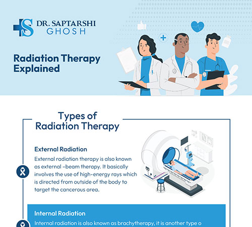 Radiation Therapy Explained