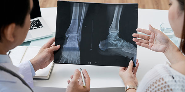 Bone metastasis